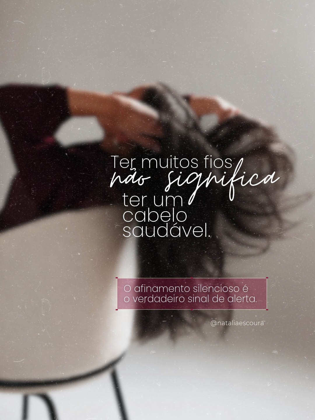 "Ainda tenho muito cabelo, doutora. Essa queda não é nada."É exatamente essa frase que me faz acender o sinal amarelo no consultório.O maior erro na tricologia é olhar apenas para o ralo do chuveiro ou para o volume que restou e achar que está tudo bem. A conta não é sobre quantos fios caem hoje, mas sobre como o fio está nascendo amanhã.Se o cabelo que cai grosso é substituído por um fio mais fino, curto e ralo — o que chamamos de miniaturização —, o problema já começou, mesmo que você ainda não veja o couro cabeludo.É um processo silencioso. Quando a falha finalmente se torna evidente a olho nu, a recuperação exige muito mais esforço e tempo do que se tivéssemos investigado a raiz do problema lá no começo.Não espere o volume sumir para buscar uma avaliação médica de verdade. O folículo precisa de diagnóstico, não de achismos.Notou que o rabo de cavalo afinou ou que os fios estão perdendo textura? Agende uma avaliação detalhada do seu couro cabeludo pelo link da bio.Natalia Escoura | CRM-MG 97920
Dermatologia | Tricologia | Cosmiatria e laser